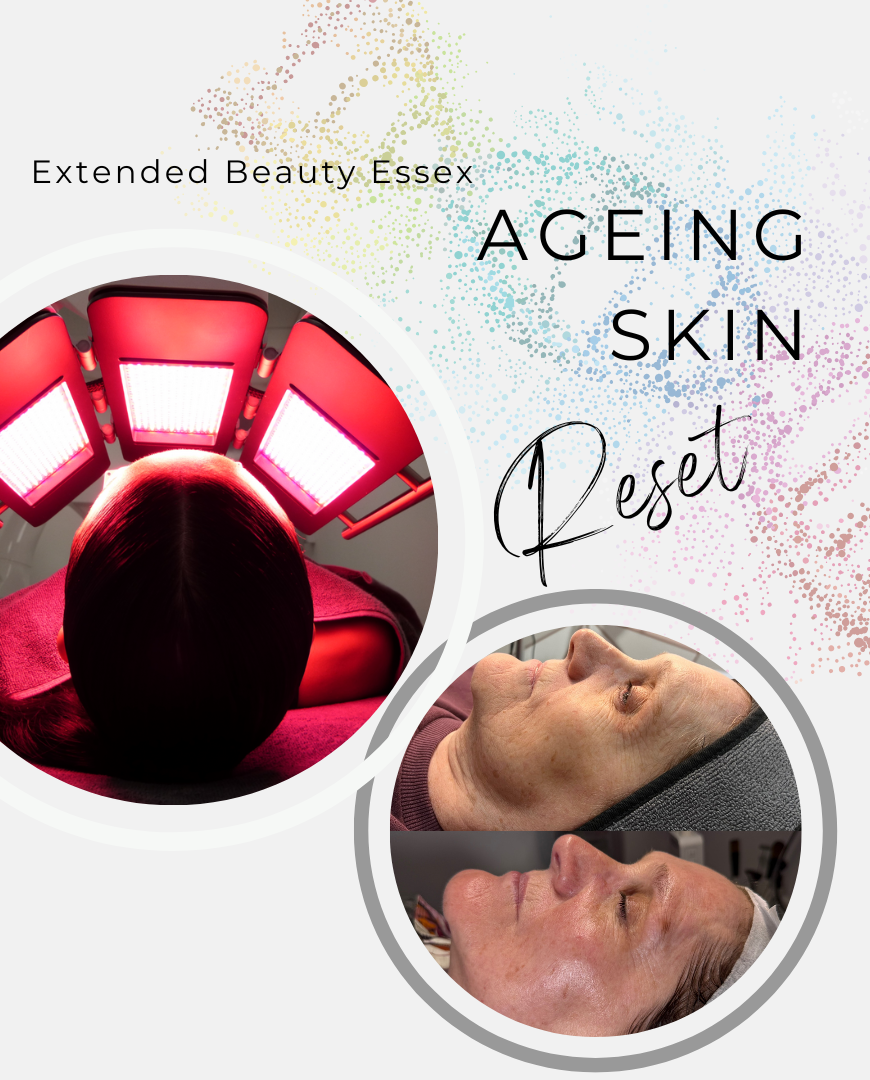 Ageing Reset Package