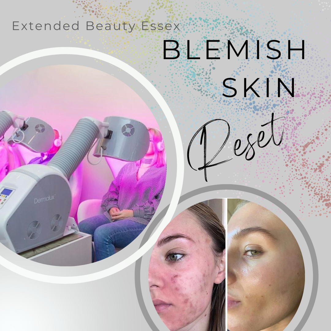Blemish Skin Reset Package